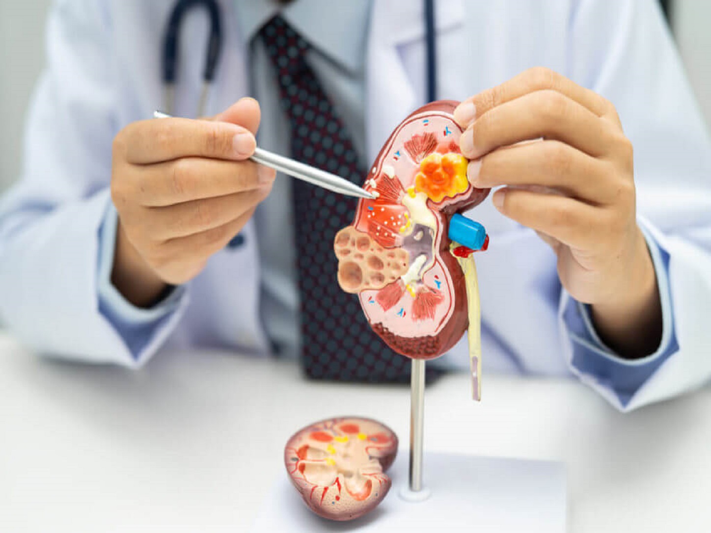 Nephrology Renal Testing and Diagnostics